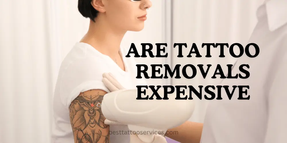 Are Tattoo Removals Expensive