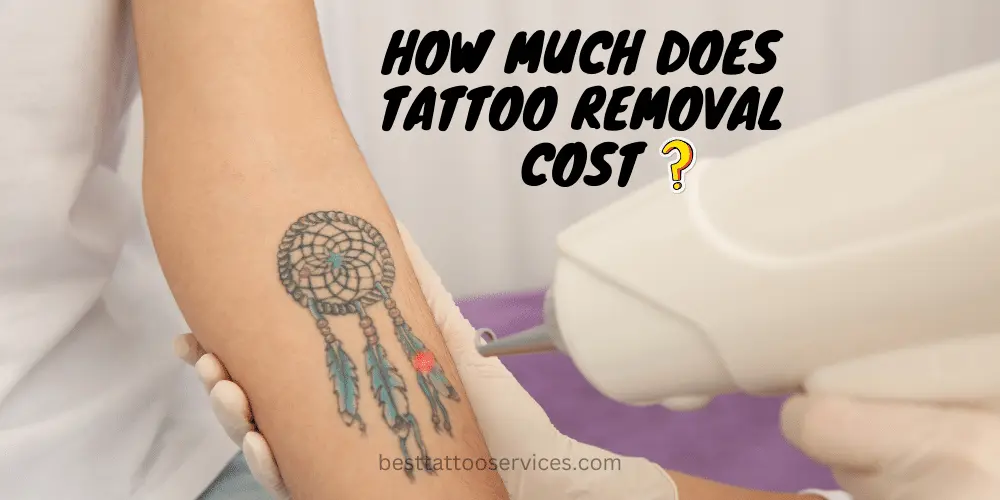 How Much Does Tattoo Removal Cost