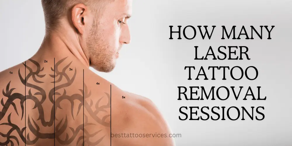 How Many Laser Tattoo Removal Sessions Are Needed