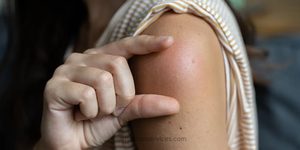 Reduce Swelling After Tattoo Removal